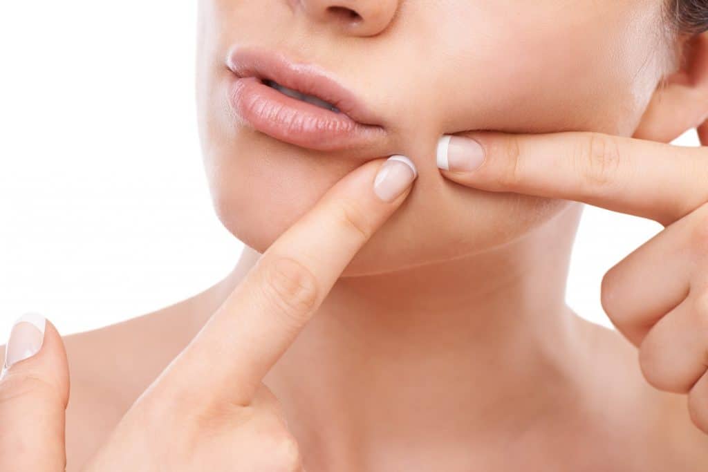 Chăm sóc da sau khi nặn mụn: 5 cách giúp da không bị thâm sau khi nặn mụn
