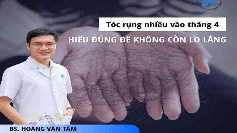 Tóc rụng nhiều vào tháng 4 – Hiểu đúng để không còn lo lắng – Bệnh viện da liễu trung ương