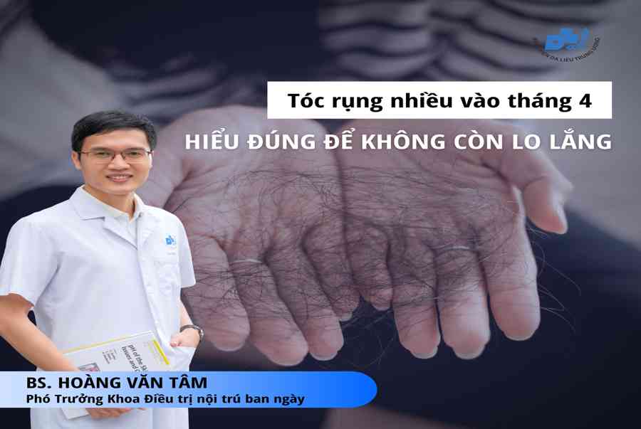 Tóc rụng nhiều vào tháng 4 – Hiểu đúng để không còn lo lắng – Bệnh viện da liễu trung ương