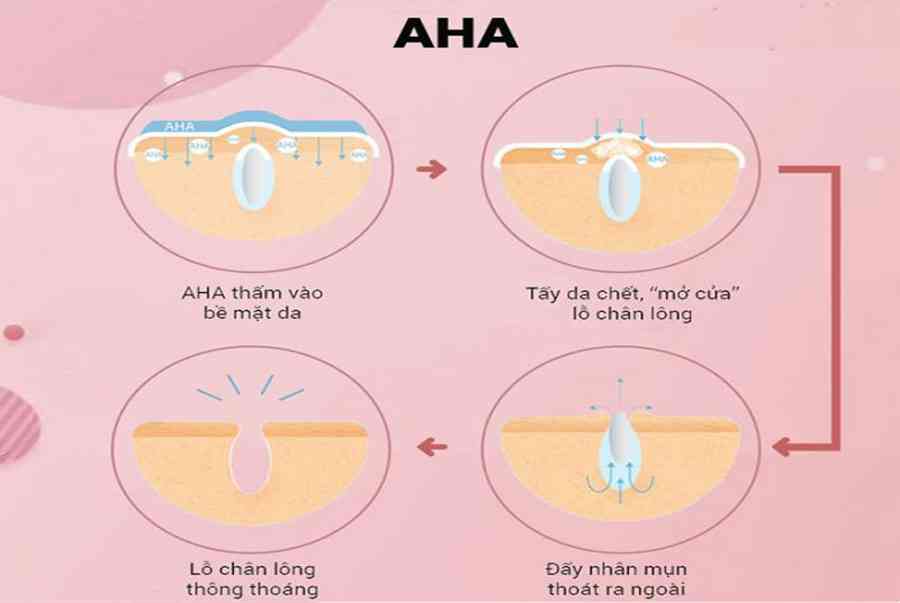 Sử dụng tẩy tế bào chết hóa học cho da mụn nên hay không ?