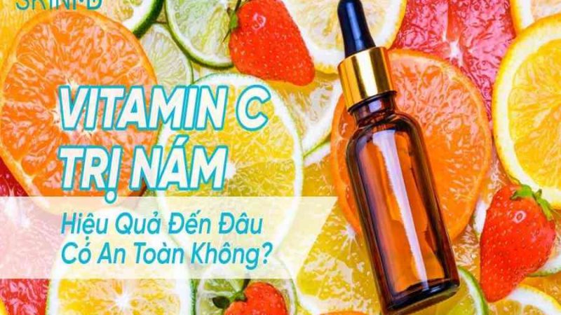 21+ cách trị nám tại nhà hiệu quả nhất với nguyên liệu thiên nhiên