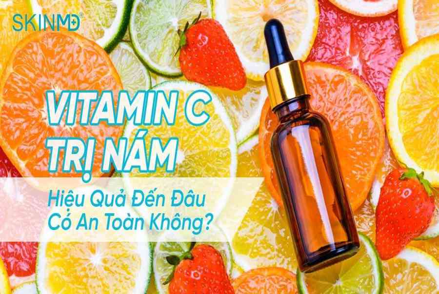 21+ cách trị nám tại nhà hiệu quả nhất với nguyên liệu thiên nhiên