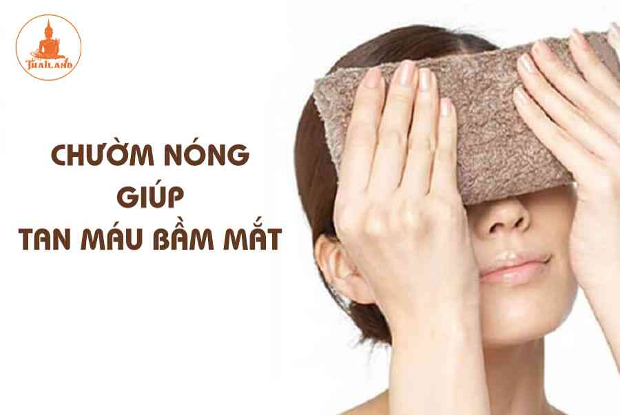 5 Cách đánh tan máu bầm ở mắt đơn giản tại nhà