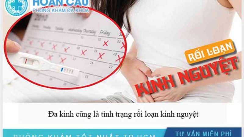 Đa kinh là gì? Nguyên nhân và điều trị đa kinh ra sao?