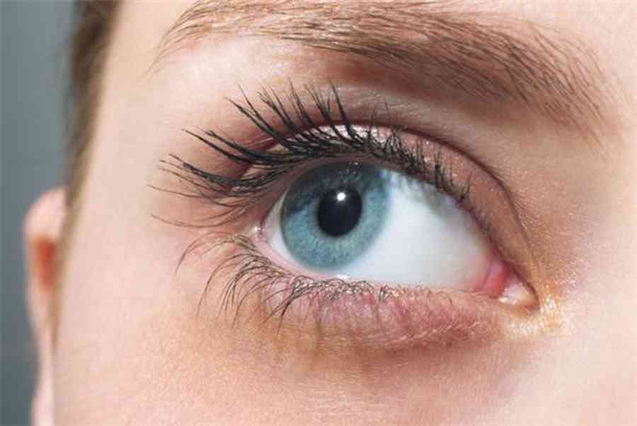 Dị ứng mắt: triệu chứng và cách khắc phục – Bệnh Viện Mắt Sài Gòn