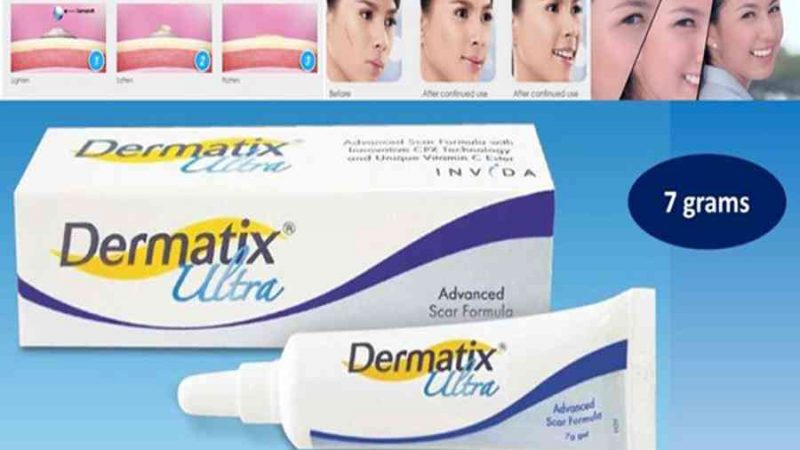 Review Kem Trị Sẹo Dermatix Ultra Có Tốt Không? Giá Bao Nhiêu?