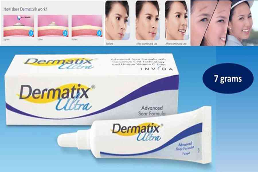 Review Kem Trị Sẹo Dermatix Ultra Có Tốt Không? Giá Bao Nhiêu?