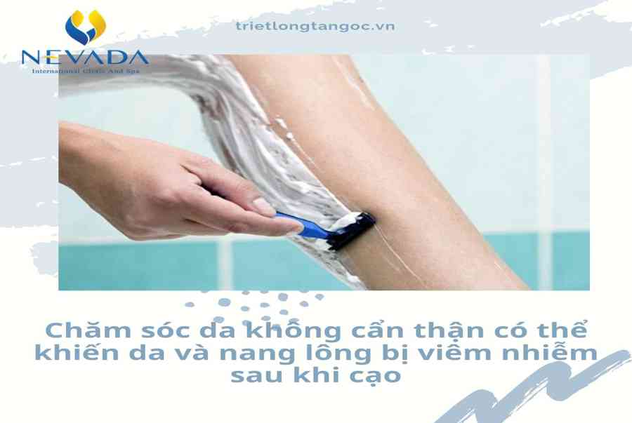 Lỡ cạo lông chân phải làm sao? Câu trả lời được chuyên gia tiết lộ