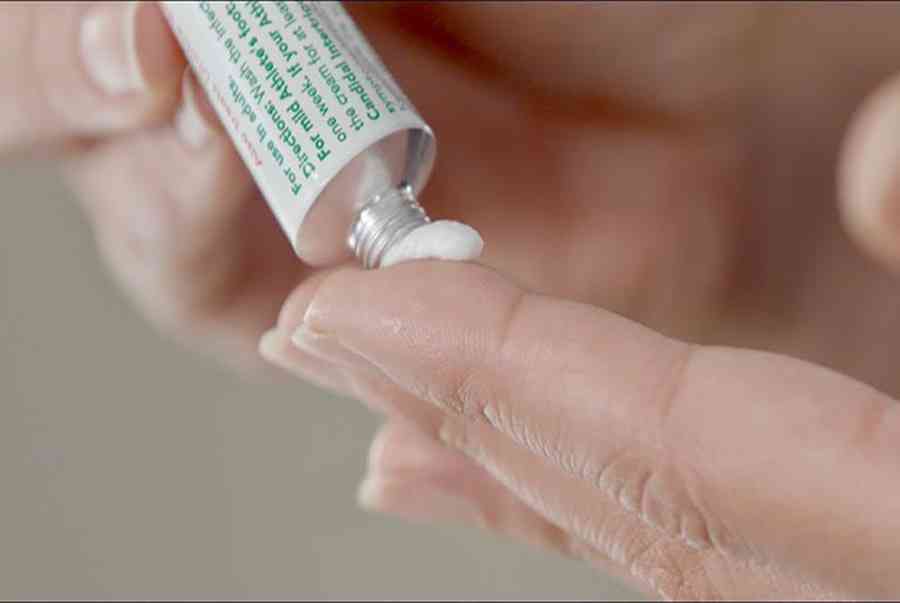 Bị nước ăn tay – Cách đặc trị tại nhà và thuốc bôi