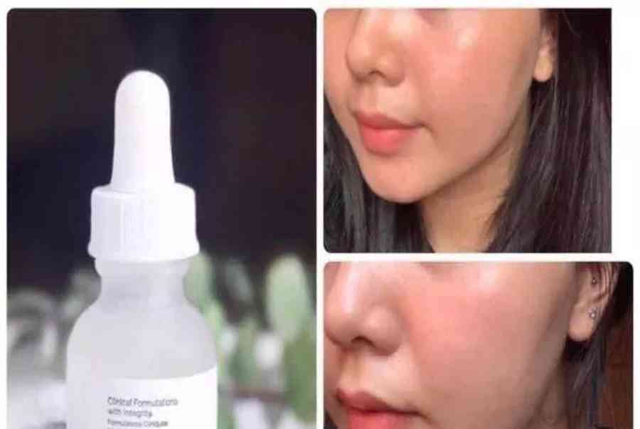 Review The Ordinary Hyaluronic Acid 2% + B5 Serum có tốt không? – BlogAnChoi