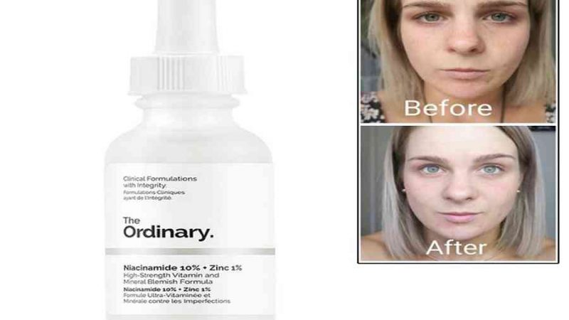 Cách Sử Dụng Serum The Ordinary Niacinamide 10% + Zinc 1% Đúng Chuẩn