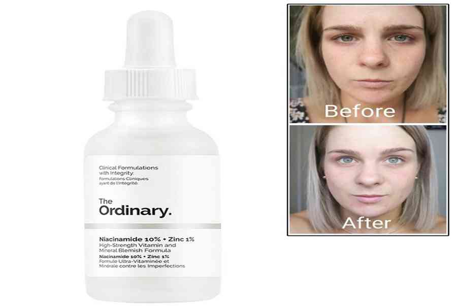 Cách Sử Dụng Serum The Ordinary Niacinamide 10% + Zinc 1% Đúng Chuẩn