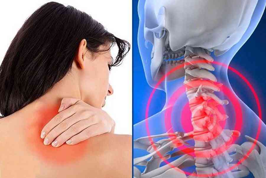 Người đau cổ nhớ 5 huyệt không tốn một xu vận động thoải mái