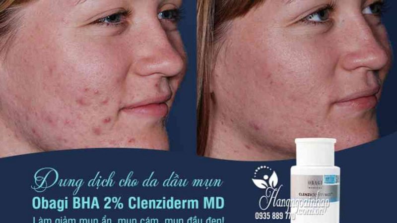 Obagi bha 2% clenziderm m.d pore therapy 148ml Mỹ, giá tốt