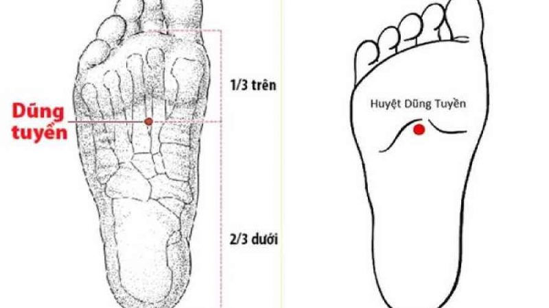 Dán thuốc vào huyệt dũng tuyền trị nhiều bệnh