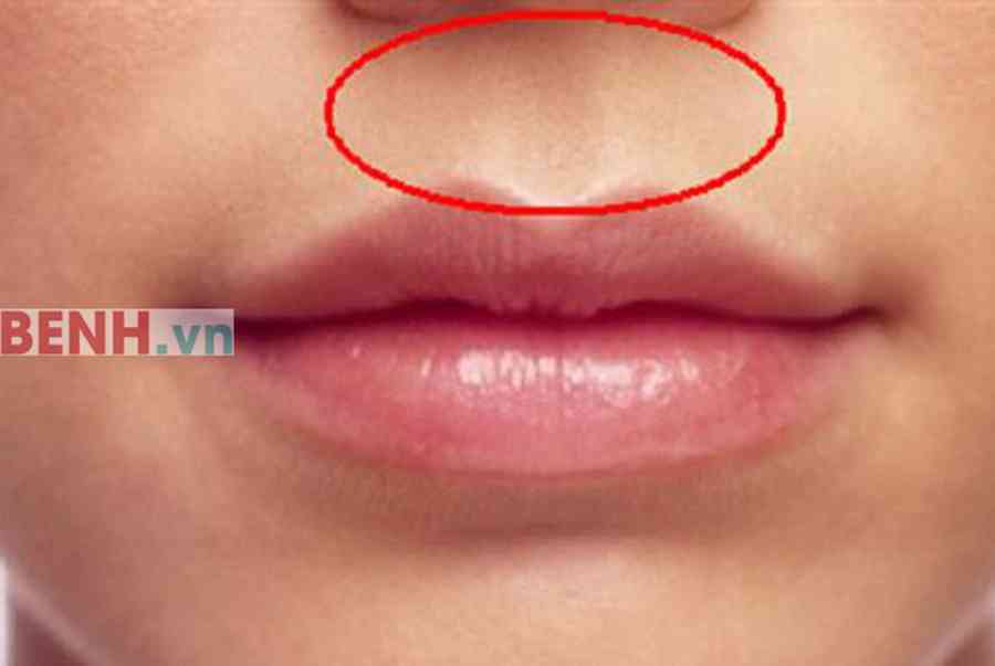Nhận biết vị trí các huyệt trên khuôn mặt để điều trị bệnh – Đông y