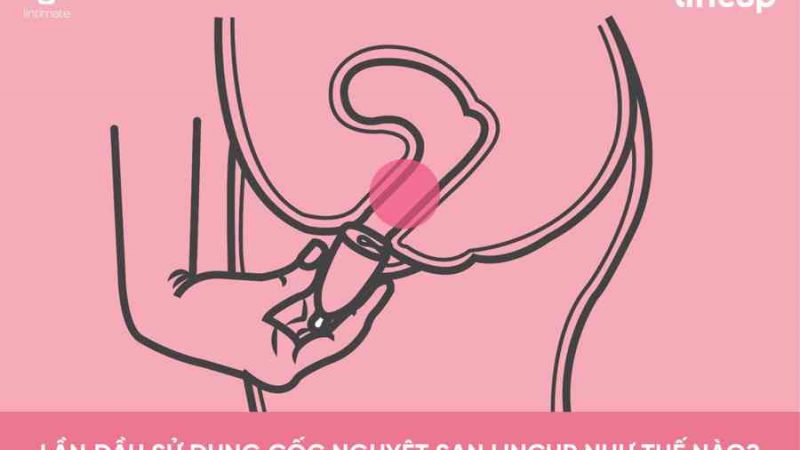 Mẹo cho lần đầu tiên sử dụng cốc nguyệt san Lincup