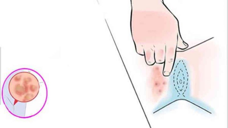 Làm hồng vùng kín bằng Vaseline: 3 Lưu ý chị em “Phải Biết”